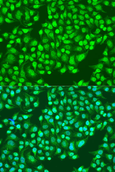 Anti-ITGA2 Antibody [KO Validated] (CAB7629)