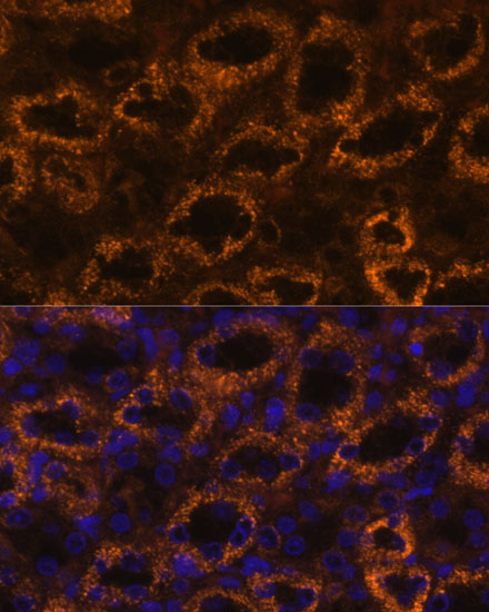 Anti-SLC7A9 Antibody (CAB12848)