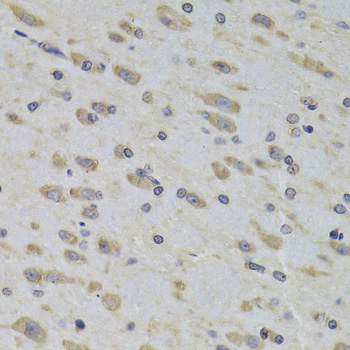 Anti-RPL3 Antibody (CAB14059)