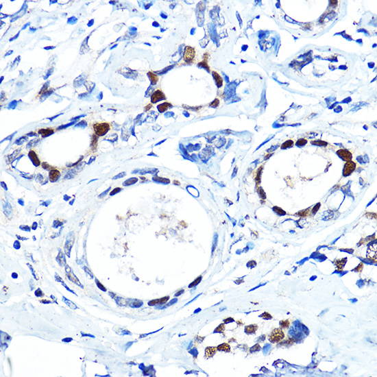 Anti-FOXA1 Antibody (CAB15278)