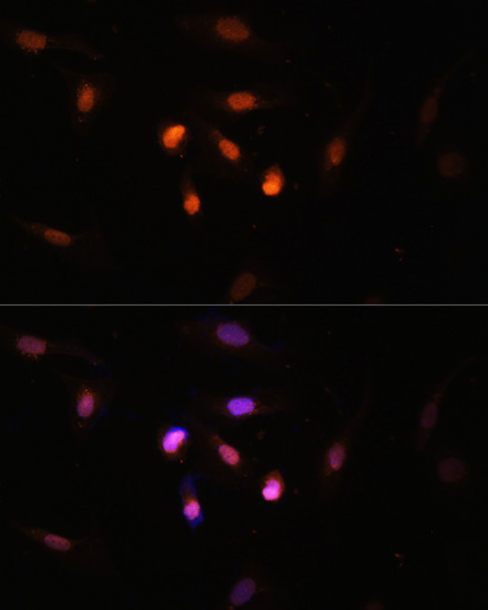 Anti-KAT6A Antibody (CAB15006)