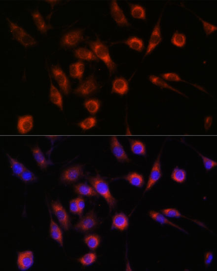 Anti-COL4A3BP Antibody (CAB15376)