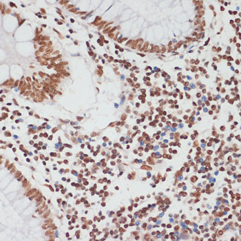 Anti-Phospho-TP53-S33 pAb (CABP0762)