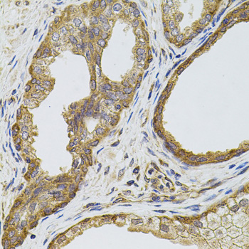 Anti-EGFR Antibody [KO Validated] (CAB11351)