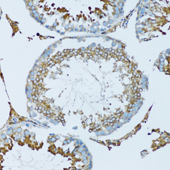 Anti-HPX Antibody (CAB5603)