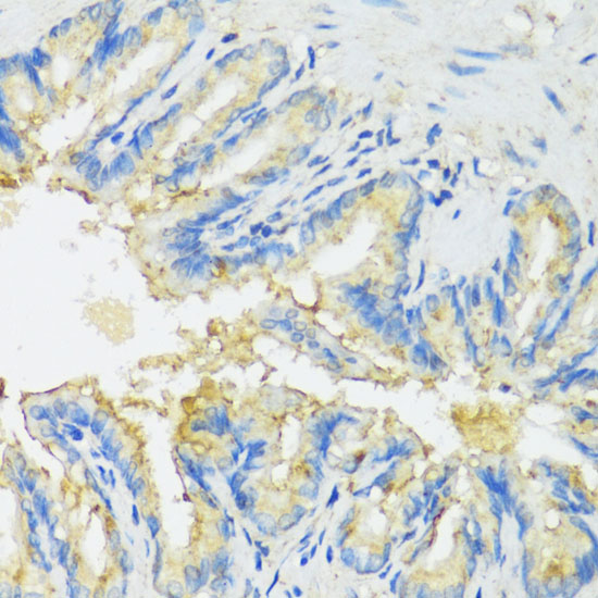 Anti-CYP11A1 Antibody (CAB16363)