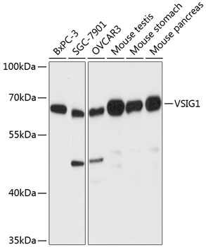 Anti-VSIG1 Antibody (CAB13875)