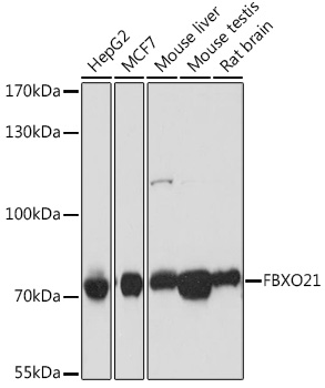 Anti-FBXO21 Antibody (CAB16107)