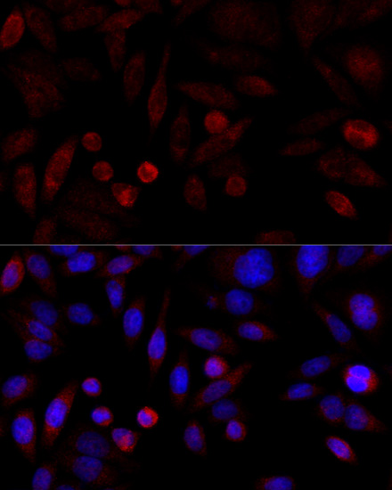 Anti-KMT2A Antibody[KO Validated]