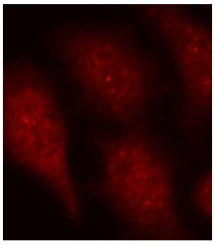 Anti-Phospho-CDK6-Y24 Antibody (CABP0289)