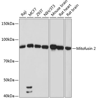 Anti-Mitofusin 2 Antibody (CAB19678)