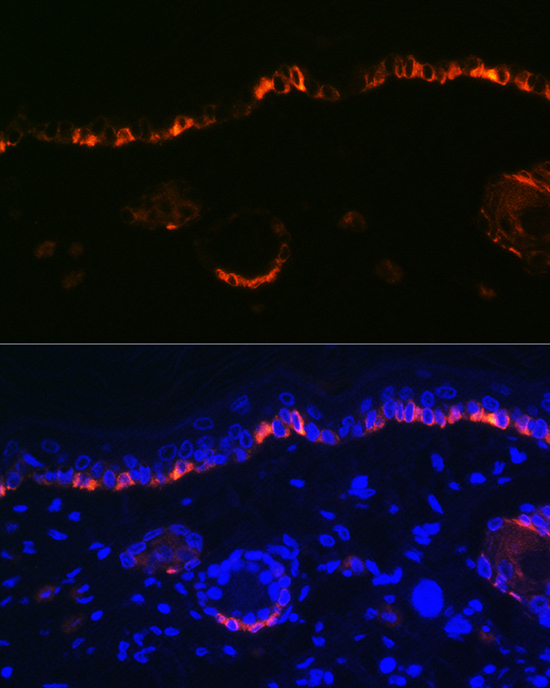 Anti-KRT14 Antibody (CAB15069)