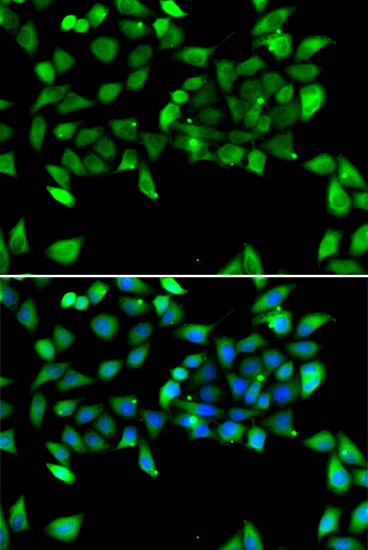 Anti-EIF3H Antibody (CAB7024)