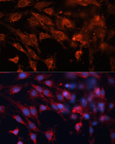 Anti-IGF2R Antibody (CAB13022)