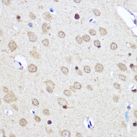 Anti-CNOT7 Polyclonal Antibody (CAB8959)