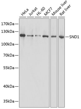 Anti-SND1 Antibody [KO Validated] (CAB13415)