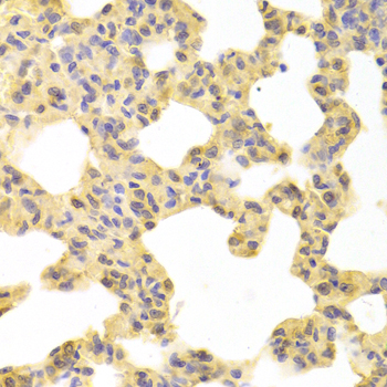 Anti-MAP2K1 Antibody (CAB0252)