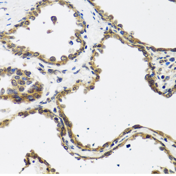 Anti-CALCB Polyclonal Antibody (CAB8105)