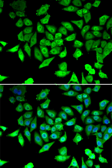 Anti-CCAR2 Antibody (CAB7126)