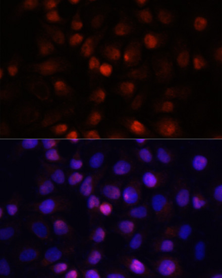 Anti-ACP1 Antibody (CAB15020)