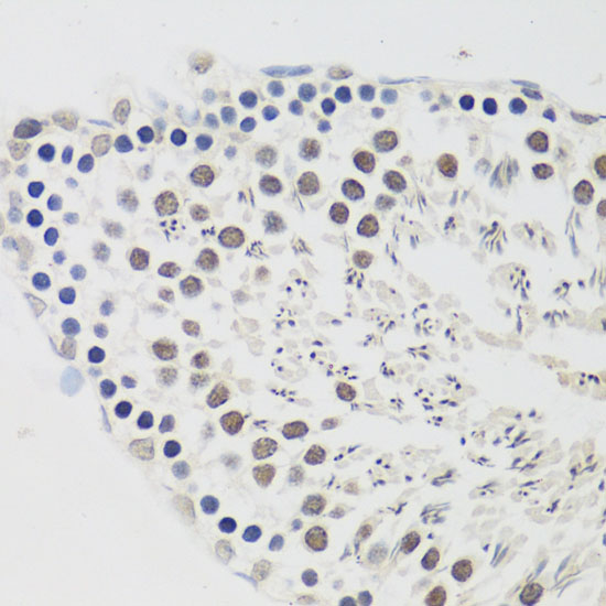 Anti-Cyclin E2 Antibody (CAB4272)