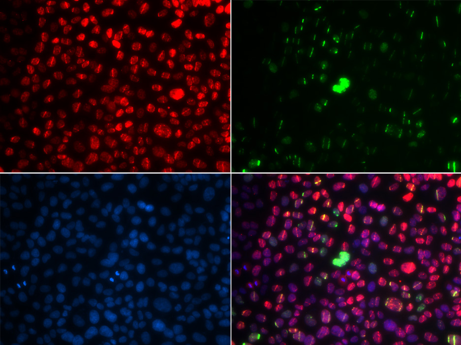 Anti-Phospho-ATM-S1981 Antibody (CABP0008)