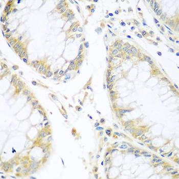 Anti-CUL3 Antibody (CAB1078)