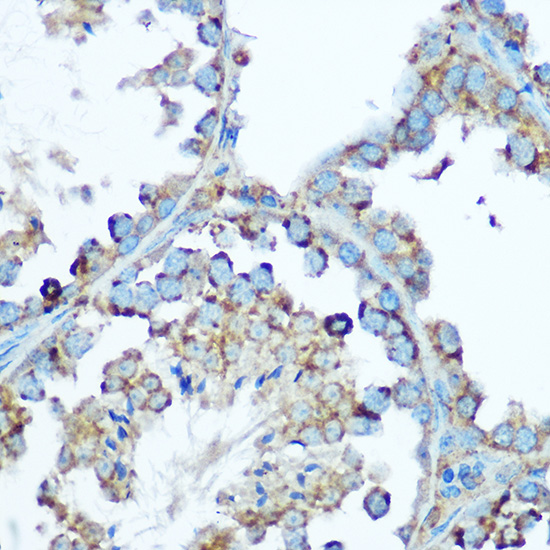 Anti-Hsp60 Antibody (CAB0969)