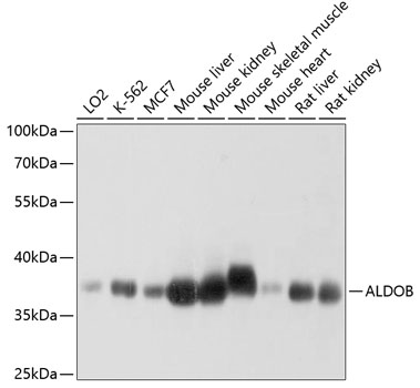 Anti-ALDOB Antibody (CAB3728)