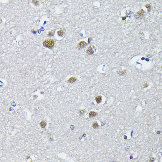 Anti-PTBP2 Antibody (CAB6054)