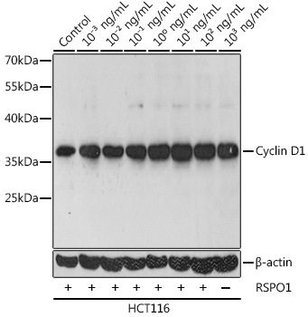 Anti-Cyclin D1 Antibody (CAB11310)