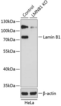 Anti-Lamin B1 Antibody [KO Validated] (CAB1910)