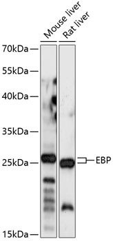 Anti-EBP Antibody (CAB14845)