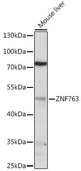 Anti-ZNF763 Antibody (CAB16615)