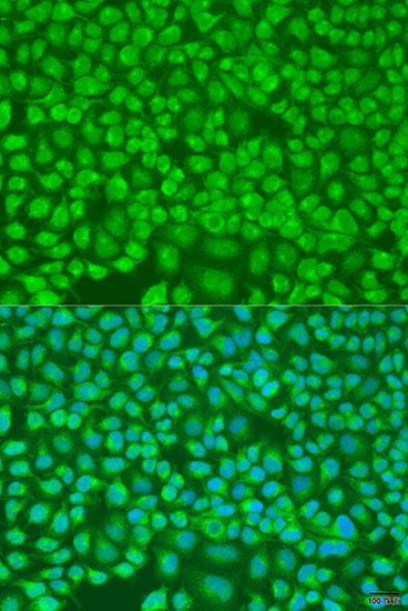 Anti-PNKD Polyclonal Antibody (CAB8203)