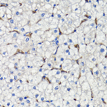 Anti-COMP Antibody (CAB13963)