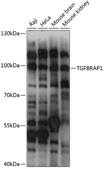 Anti-TGFBRAP1 Antibody (CAB14386)