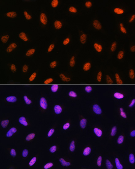 Anti-DDIT3 / CHOP Antibody (CAB0221)