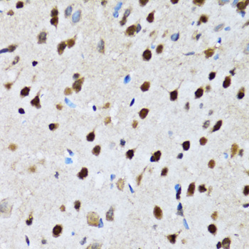 Anti-CCAR2 Antibody (CAB7126)