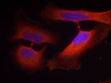 Anti-Phospho-KRT8-S74 Antibody (CABP0386)