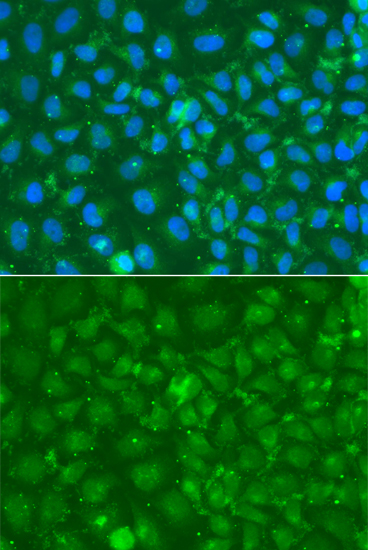 Anti-SRGN Antibody (CAB13340)