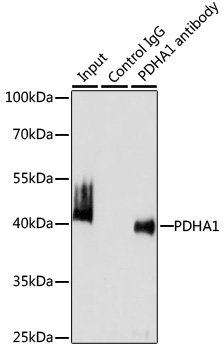 Anti-PDHA1 Antibody (CAB1895)