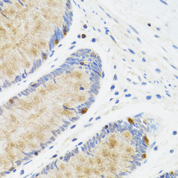 Anti-STAT4 Antibody (CAB6991)