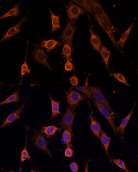 Anti-PDCD4 Antibody (CAB2420)