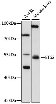 Anti-ETS2 Antibody (CAB7329)