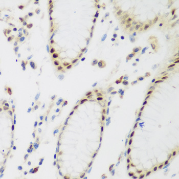 Anti-PPAN Antibody (CAB7377)