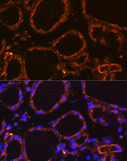 Anti-WNT5A Antibody (CAB12744)