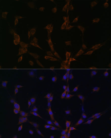 Anti-DYNLL2 Antibody (CAB13888)