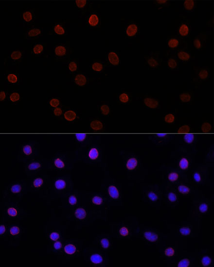 Anti-SUN2 Antibody (CAB16325)