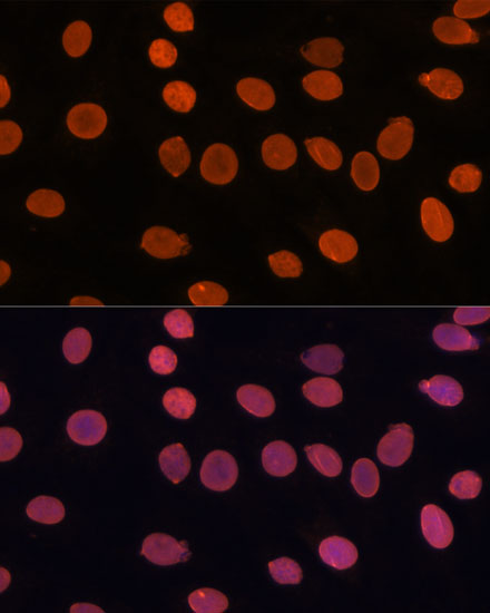 Anti-TADA3 Antibody (CAB6224)